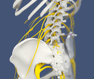 Lumbar Sympathetic Block