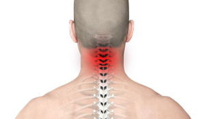   Neck Pain 