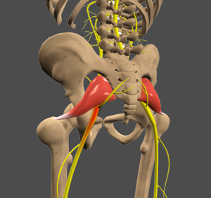 Sciatica 