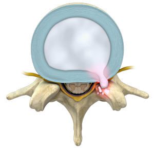 Thoracic Spine Anatomy